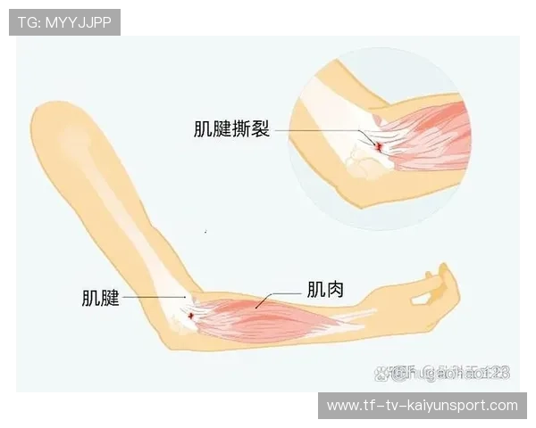 足坛伤病季:关节与肌腱高发部位统计,肌腱是关节囊吗 足坛伤病季:关节与肌腱高发部位统计,肌腱是关节囊吗